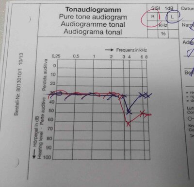 audiogram 2017 - Copy.jpg