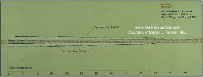 45ACP 230gr FMJ.jpg